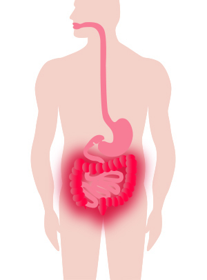 Digestive System showing ulcerative colitis inflammation