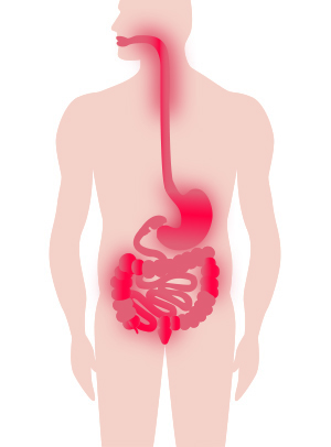 Digestive System showing Crohn's disease inflammation